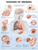 ACC Anatomical Chart, Dangers of Smoking, 20" x 26", Laminated (Each)